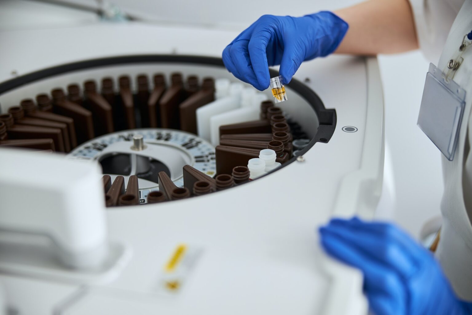 Scientist performing a lab analysis using a clinical chemistry analyzer